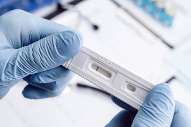 Coronavirus antijen covid kiti test ediyor. Doktor hızlı kovid tıbbi test yapıyor. Laboratuvar hastanesinin laboratuvar geçmişi. Hızlı bir antijen tespit RADT testi
