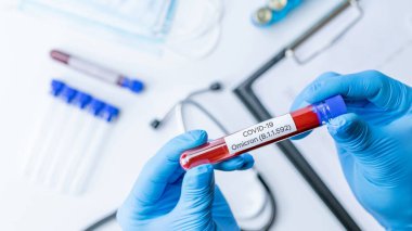 Omicron Corona virüsü varyantı. Tıbbi laboratuvar doktoru hastane laboratuarında deney tüpü tutuyor. Pozitif Omicron COVID-19 kan testi