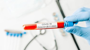 Omicron Corona virüsü varyantı. Tıbbi laboratuvar doktoru hastane laboratuarında deney tüpü tutuyor. Pozitif Omicron COVID-19 kan testi