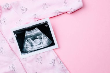 Ultrason fotoğrafı hamile bebek fotoğrafı. Pembe arka planda ultrason görüntüsü olan sevimli bebek bezi. Hamilelik, ilaç, eczacılık, sağlık ve insan konsepti