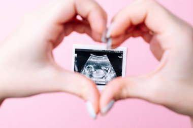 Ultrason fotoğraflı hamilelik bebeği. Kadın elleri pembe arka planda ultrason ile hamile fotoğrafı tutuyor. Gebelik, gebelik, doğum