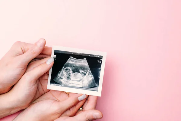 Ultraljudsbild Gravid Baby Foto Kvinnliga Händer Som Håller Ultraljud Graviditet — Stockfoto