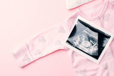 Ultrason görüntüsü hamile bebek fotoğrafı. Pembe arka planda ultrason fotoğraflı şirin bebek bezi. Gebelik, gebelik, doğum