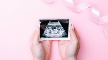 Ultrason fotoğrafı hamile bebek fotoğrafı. Kadın elleri pembe arka planda ultrason görüntüsü tutuyor. Hamilelik kavramı, annelik, bebek doğumu beklentisi