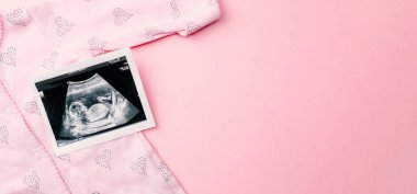Ultrason fotoğrafı hamile bebek fotoğrafı. Pembe arka planda ultrason görüntüsü olan sevimli bebek bezi. Hamilelik, ilaç, eczacılık, sağlık ve insan konsepti
