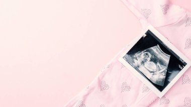 Ultrason fotoğrafı hamile bebek fotoğrafı. Pembe arka planda ultrason görüntüsü olan sevimli bebek bezi. Hamilelik, ilaç, eczacılık, sağlık ve insan konsepti