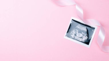 Ultrason fotoğraflı hamilelik bebeği. Pembe arka planda ultrason fotoğraflı şirin bebek bezi. Hamilelik kavramı, annelik, bebek doğumu beklentisi