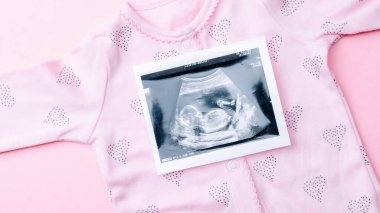 Ultrason fotoğrafı hamile bebek fotoğrafı. Pembe arka planda ultrason görüntüsü olan sevimli bebek bezi. Hamilelik, ilaç, eczacılık, sağlık ve insan konsepti