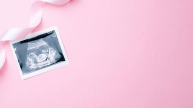 Ultrason görüntüsü hamile bebek fotoğrafı. Pembe arka planda ultrason fotoğraflı şirin bebek bezi. Gebelik, gebelik, doğum