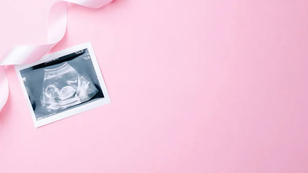 Ultraljudsbild Gravid Baby Foto Mode Söt Babyduk Med Ultraljud Graviditetsbild — Stockfoto