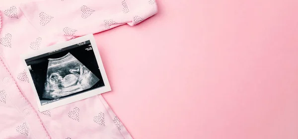 Ultraljudsbild Gravid Baby Foto Mode Söt Babyduk Med Ultraljud Graviditet — Stockfoto
