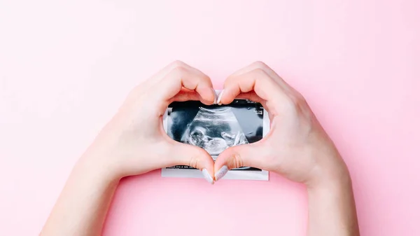 Ultraljudsbild Gravid Baby Foto Kvinnliga Händer Som Håller Ultraljud Graviditet — Stockfoto