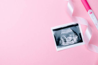 Ultrason görüntüsü hamile bebek fotoğrafı. Pembe arka planda ultrason fotoğraflı şirin bebek bezi. Gebelik, gebelik, doğum