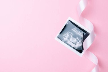 Ultrason görüntüsü hamile bebek fotoğrafı. Pembe arka planda ultrason fotoğraflı şirin bebek bezi. Gebelik, gebelik, doğum.