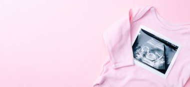 Ultrason görüntüsü hamile bebek fotoğrafı. Pembe arka planda ultrason fotoğraflı şirin bebek bezi. Gebelik, gebelik, doğum