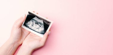 Ultrason fotoğraflı hamilelik bebeği. Kadın elleri pembe arka planda ultrason ile hamile fotoğrafı tutuyor. Gebelik, gebelik, doğum