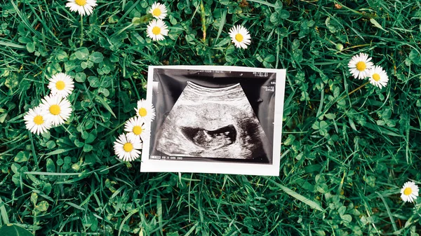 Ultrason Fotoğrafı Hamile Bebek Fotoğrafı Çim Çiçeklerinin Arka Planında Ultrason — Stok fotoğraf
