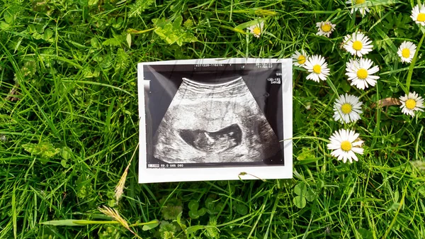 超音波写真妊娠の赤ちゃん 草の花の背景に超音波妊娠画像 コンセプト妊産婦妊娠出産 — ストック写真