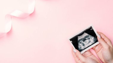 Ultrason görüntüsü hamile bebek fotoğrafı. Kadın elleri pembe arka planda ultrasonlu hamilelik fotoğrafı tutuyor. Hamilelik, ilaç, eczacılık, sağlık ve insan konsepti