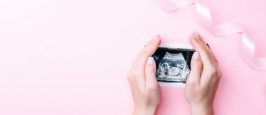 Ultrason görüntüsü hamile bebek fotoğrafı. Kadın elleri pembe arka planda ultrasonlu hamilelik fotoğrafı tutuyor. Hamilelik, ilaç, eczacılık, sağlık ve insan konsepti