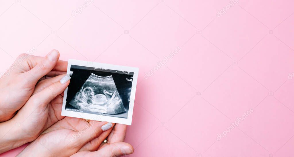 Ultrasound photo pregnancy baby. Woman hands holding ultrasound pregnant picture on pink background. Concept maternity, pregnancy, childbirth