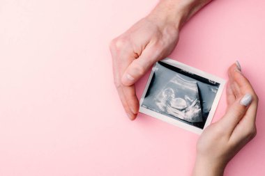 Ultrason fotoğrafı hamile bebek fotoğrafı. Kadın elleri pembe arka planda ultrason görüntüsü tutuyor. Hamilelik kavramı, annelik, bebek doğumu beklentisi