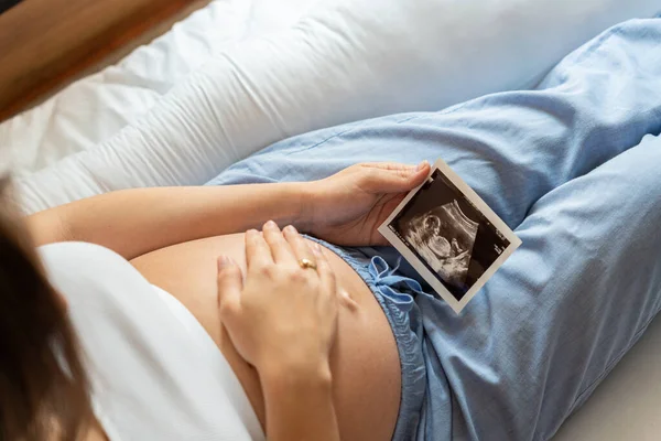 Ultrazvuk Těhotné Dítě Foto Žena Ultrazvukovou Těhotenskou Fotkou Těhotenství Medicína — Stock fotografie