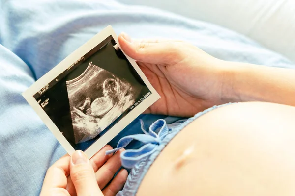 Imagen Ultrasonido Del Bebé Embarazada Foto Mujer Con Imagen Embarazo — Foto de Stock