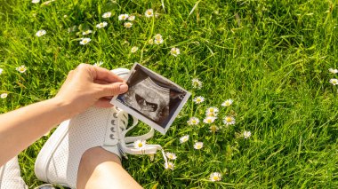 Ultrason fotoğraflı hamilelik bebeği. Elinde ultrason tutan bir kadın çiçek arka planında hamile fotoğrafı taşıyor. Konsept annelik, hamilelik, doğum