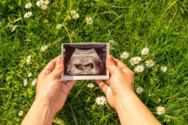 Ultrason fotoğraflı hamilelik bebeği. Elinde ultrason tutan bir kadın çiçek arka planında hamile fotoğrafı taşıyor. Konsept annelik, hamilelik, doğum