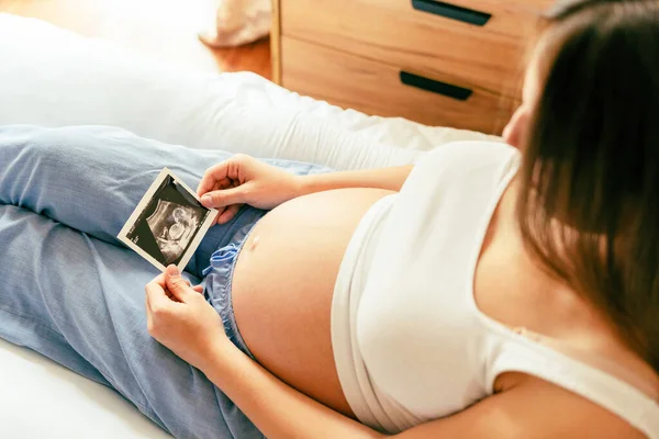 Υπερηχογράφημα Φωτογραφία Εγκυμοσύνη Μωρό Μου Γυναίκα Κρατώντας Υπέρηχο Έγκυος Εικόνα — Φωτογραφία Αρχείου