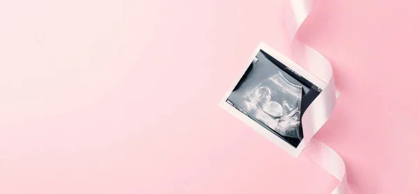 Ultrason Fotoğraflı Hamilelik Bebeği Pembe Arka Planda Ultrason Fotoğraflı Şirin — Stok fotoğraf
