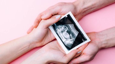Ultrason fotoğrafı hamile bebek fotoğrafı. Kadın elleri pembe arka planda ultrason görüntüsü tutuyor. Hamilelik kavramı, annelik, bebek doğumu beklentisi