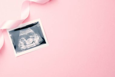 Ultrason fotoğraflı hamilelik bebeği. Pembe arka planda ultrason fotoğraflı şirin bebek bezi. Hamilelik kavramı, annelik, bebek doğumu beklentisi