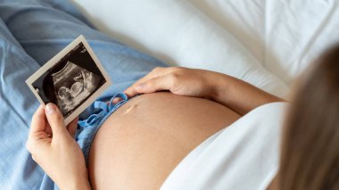 Ultrason fotoğrafı hamile bebek fotoğrafı. Ultrason görüntüsü taşıyan bir kadın. Hamilelik kavramı, annelik, bebek doğumu beklentisi