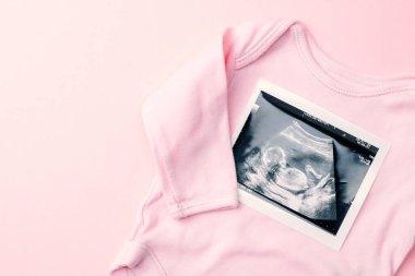 Ultrason fotoğraflı hamilelik bebeği. Pembe arka planda ultrason fotoğraflı şirin bebek bezi. Hamilelik kavramı, annelik, bebek doğumu beklentisi