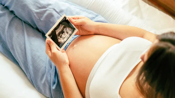 Υπερηχογράφημα Φωτογραφία Εγκυμοσύνη Μωρό Μου Γυναίκα Κρατώντας Υπέρηχο Έγκυος Εικόνα — Φωτογραφία Αρχείου