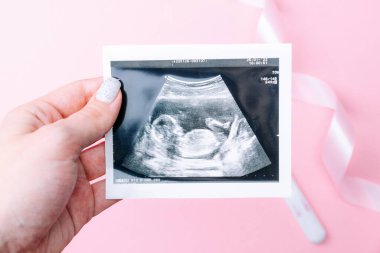 Ultrason fotoğraflı hamilelik bebeği. Kadın elleri pembe arka planda ultrason ile hamile fotoğrafı tutuyor. Gebelik, gebelik, doğum