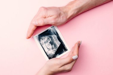 Ultrason görüntüsü hamile bebek fotoğrafı. Kadın elleri pembe arka planda ultrasonlu hamilelik fotoğrafı tutuyor. Hamilelik, ilaç, eczacılık, sağlık ve insan konsepti