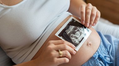 Ultrason görüntüsü hamile bebek fotoğrafı. Ultrason hamilelik fotoğrafı tutan bir kadın. Hamilelik, ilaç, eczacılık, sağlık ve insan konsepti