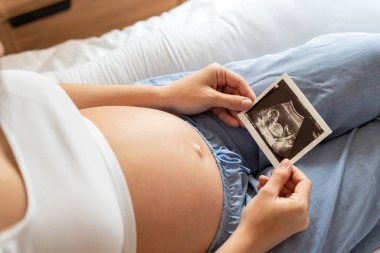 Ultrason fotoğraflı hamilelik bebeği. Elinde ultrason olan hamile bir kadın. Gebelik, gebelik, doğum