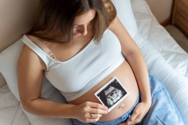 Ultrason görüntüsü hamile bebek fotoğrafı. Ultrason hamilelik fotoğrafı tutan bir kadın. Hamilelik, ilaç, eczacılık, sağlık ve insan konsepti