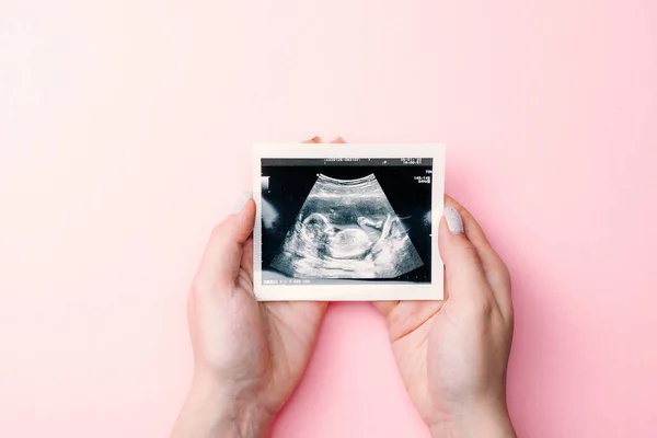 Ultraljudsfoto Graviditet Baby Kvinnliga Händer Håller Ultraljud Gravid Bild Rosa — Stockfoto