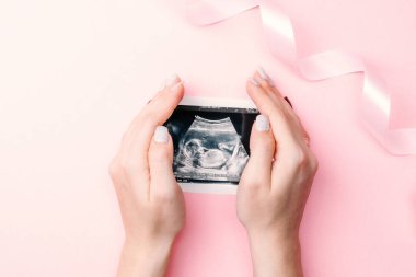 Ultrason fotoğraflı hamilelik bebeği. Kadın elleri pembe arka planda ultrason ile hamile fotoğrafı tutuyor. Gebelik, gebelik, doğum