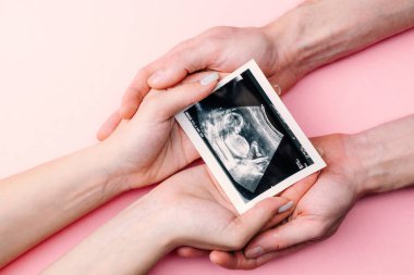 Ultrason görüntüsü hamile bebek fotoğrafı. Kadın elleri pembe arka planda ultrasonlu hamilelik fotoğrafı tutuyor. Hamilelik, ilaç, eczacılık, sağlık ve insan konsepti