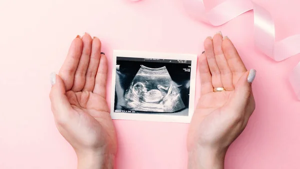 Ultraljudsfoto Graviditet Baby Kvinnliga Händer Håller Ultraljud Gravid Bild Rosa — Stockfoto