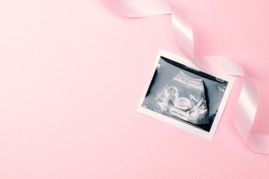 Ultrason fotoğraflı hamilelik bebeği. Pembe arka planda ultrason fotoğraflı şirin bebek bezi. Hamilelik kavramı, annelik, bebek doğumu beklentisi
