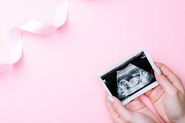 Ultrason görüntüsü hamile bebek fotoğrafı. Kadın elleri pembe arka planda ultrasonlu hamilelik fotoğrafı tutuyor. Hamilelik, ilaç, eczacılık, sağlık ve insan konsepti