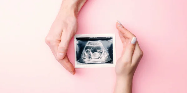 Ultrasonido Foto Embarazo Bebé Manos Mujer Sosteniendo Ultrasonido Imagen Embarazada — Foto de Stock