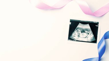 Ultrason fotoğraflı hamilelik bebeği. Mavi, pembe kurdeleli, beyaz arka planda ultrasonlu hamilelik fotoğrafı. Gebelik, gebelik, doğum
